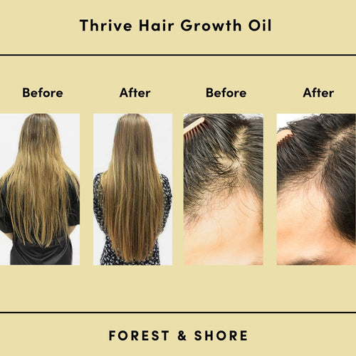 Rosemary Hair Growth Oil