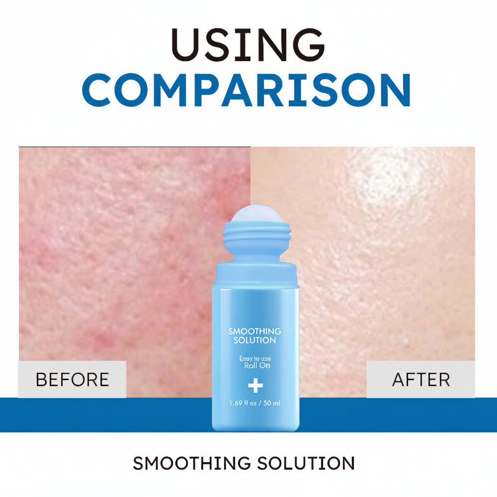 Ingrown Hair Treatment Roll-On  - Smooth, Clear Skin Solution