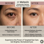 Korean Calcium Dark Spot Eye Cream