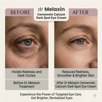 Korean Calcium Dark Spot Eye Cream